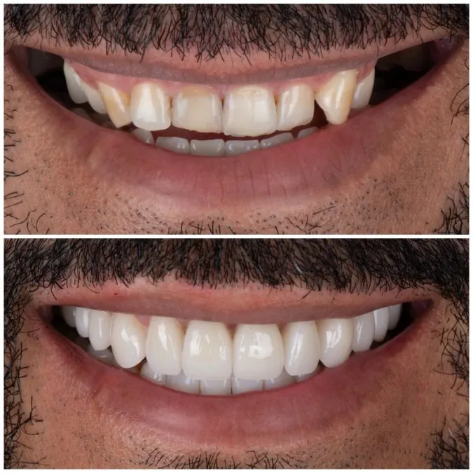 SMYLE patient transformation 6